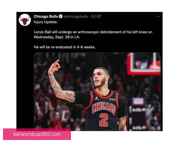 公牛伤情最新更新 西蒙斯与艾维出战火箭成疑有望回归